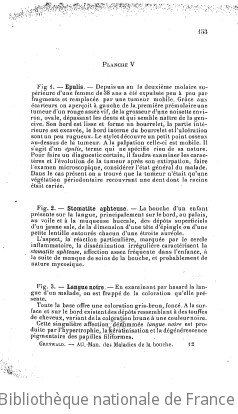 Atlas-manuel des maladies de la bouche, du pharynx et des fosses nasales / par le Dr L. Grünwald ; édition française par le Dr Georges Laurens,...