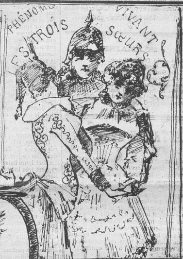 Phénomène vivant : les trois sœurs [Allemagne, Autriche, Russie]. La triple alliance ou le Canard à 3 becs. Image publiée à Toulouse le 9 mars 1884 dans le journal : La Bombe