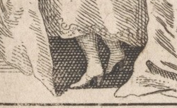 ANDRY de BOISREGARD, Nicolas (1658-1742) L'Orthopédie