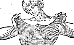 BERENGARIO da CARPI (1460?-1530?) Commentaria, cum amplissimis additionibus super anatomia Mundini