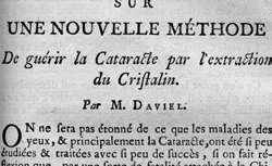 DAVIEL, Jacques (1693-1762) Sur une nouvelle méthode de guérir la cataracte par l'extraction du cristalin