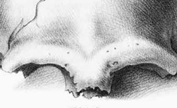 FUHLROTT, Johann Carl (1803-1877) Menschliche Überreste aus einer Felsengrotte des Düsselthals