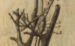 LANCISI, Giovanni Maria (1654-1720) De motu cordis et aneurysmatibus