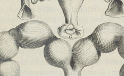 MAURICEAU, François (1637-1709) Des Maladies des femmes grosses et accouchées