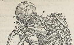 PARÉ, Ambroise (1509?-1590) Cinq livres de chirurgie