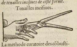 PARÉ, Ambroise (1509?-1590) La Méthode de traicter les playes